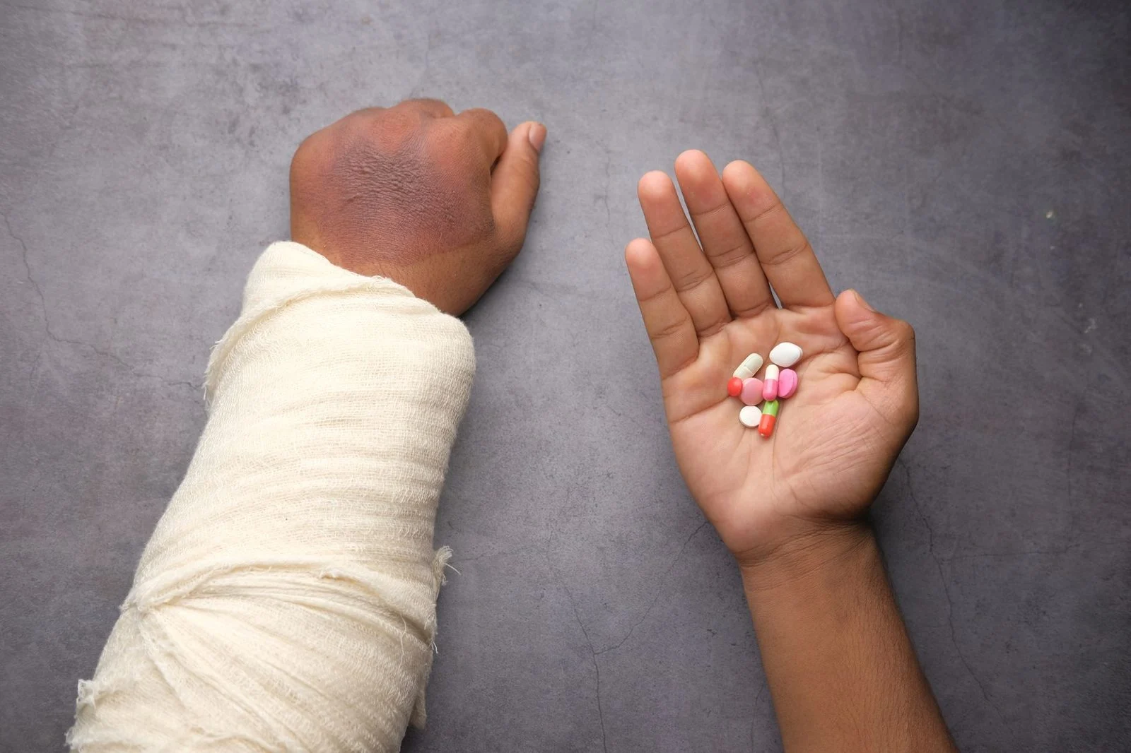 Close-up of a bandaged arm beside scattered pills on a gray background